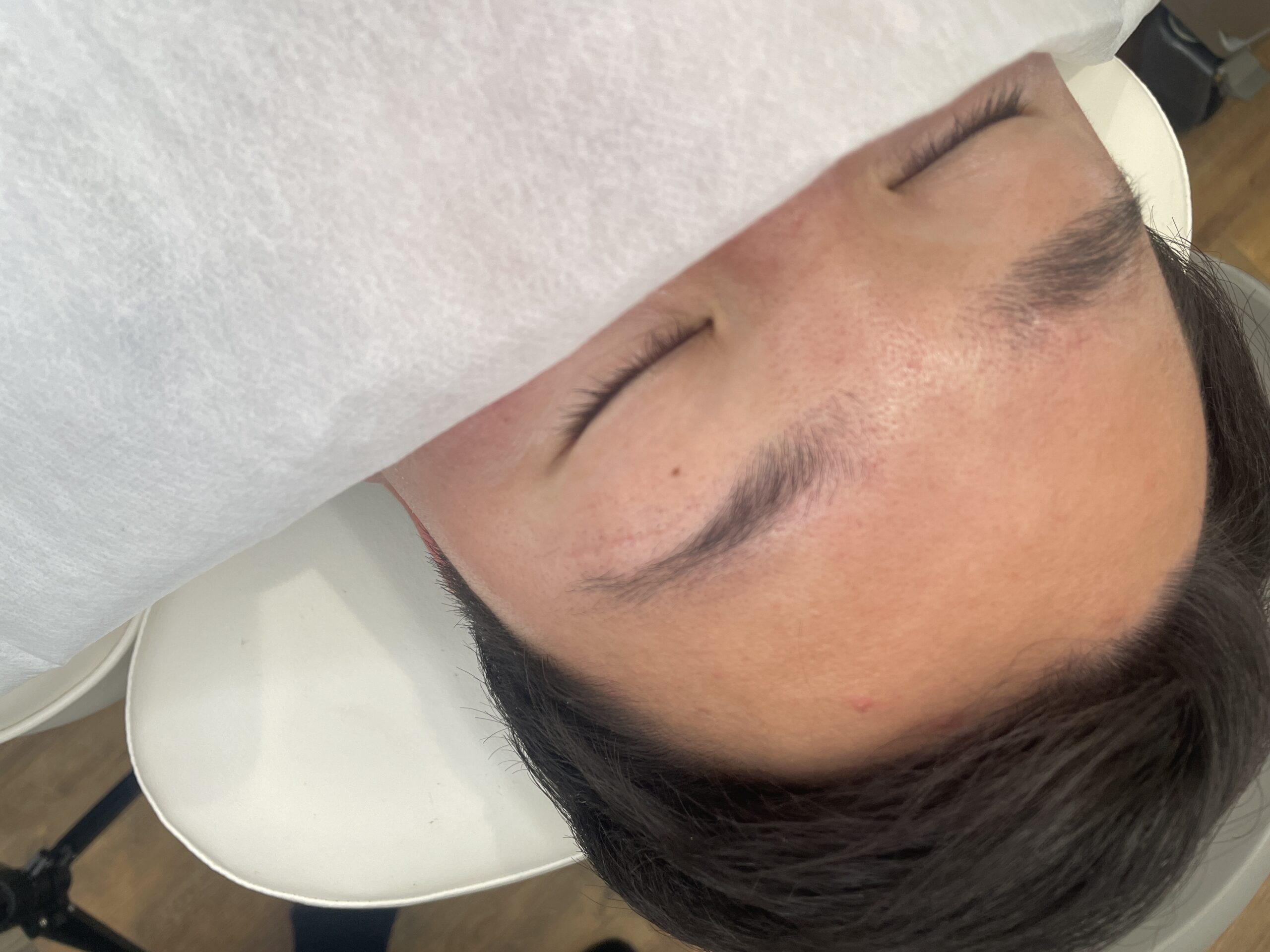 BEFORE